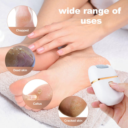 SmoothStep Electric Foot File
