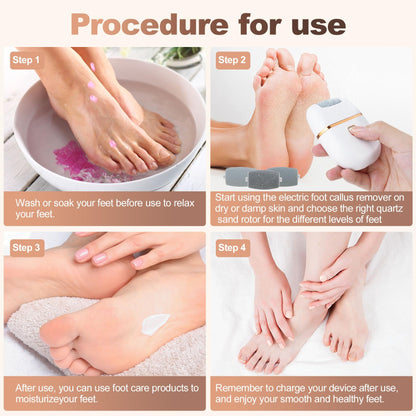 SmoothStep Electric Foot File