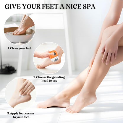 SmoothStep Electric Foot File