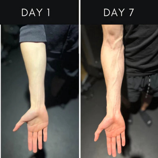 Forearm Shredder